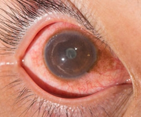 middle coat of the eyeball